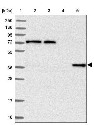 Western Blot: C11orf54 Antibody [NBP1-87193]