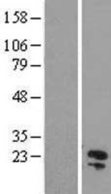 Western Blot: C11orf54 Overexpression Lysate [NBL1-08110]