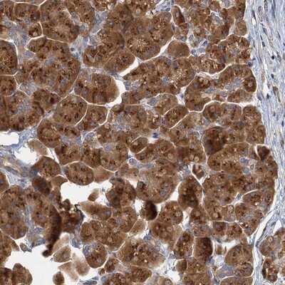 Immunohistochemistry-Paraffin: NKAPD1 Antibody [NBP1-84606]