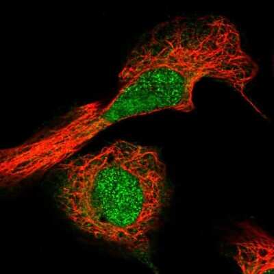 Immunocytochemistry/ Immunofluorescence: AAMDC Antibody [NBP2-31969]