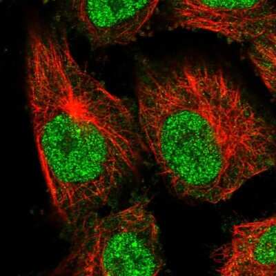 Immunocytochemistry/ Immunofluorescence: AAMDC Antibody [NBP2-34040]