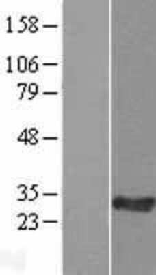 Western Blot: IFTAP Overexpression Lysate [NBL1-08120]