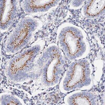 Immunohistochemistry-Paraffin: C11orf96 Antibody [NBP1-90866]