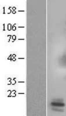 Western Blot: SPX Overexpression Lysate [NBL1-08138]