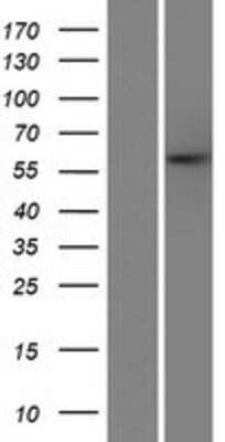 Western Blot: PARPBP Overexpression Lysate [NBP2-06899]