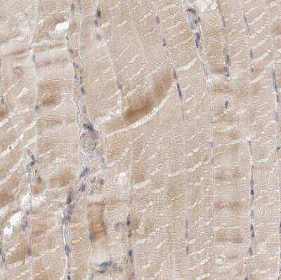 Immunohistochemistry-Paraffin: C12orf49 Antibody [NBP1-82144]