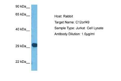 Western Blot: C12orf49 Antibody [NBP2-87035]