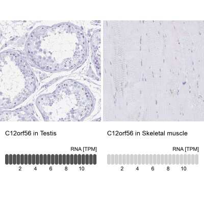 Immunohistochemistry-Paraffin: C12orf56 Antibody [NBP2-30788]