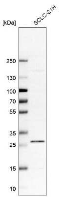 Western Blot: C12orf65 Antibody [NBP1-81934]