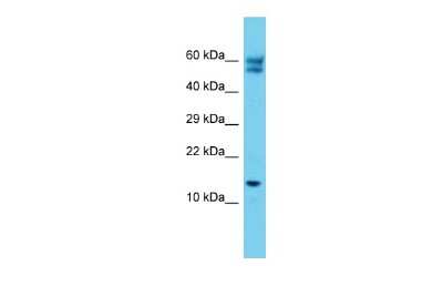 Western Blot: C12orf65 Antibody [NBP2-84538]