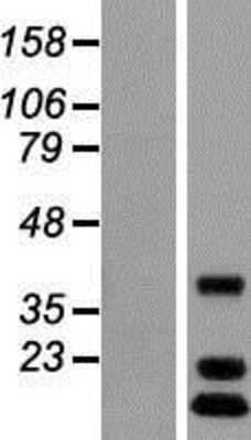 Western Blot: C12orf65 Overexpression Lysate [NBL1-08156]