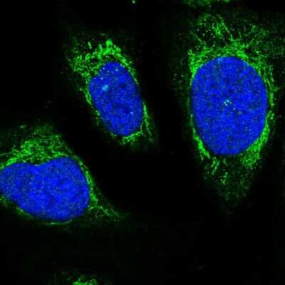 Immunocytochemistry/ Immunofluorescence: C12orf73 Antibody [NBP1-90536]