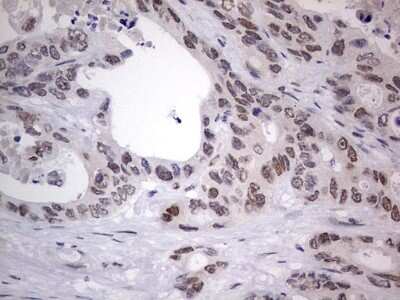 Immunohistochemistry: CLE7 homolog Antibody (OTI2A4) [NBP2-46591]