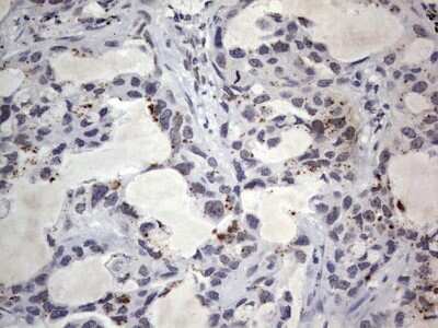 Immunohistochemistry: CLE7 homolog Antibody (OTI2A4) [NBP2-46591]