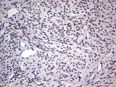 Immunohistochemistry: CLE7 homolog Antibody (OTI2A4) [NBP2-46591]