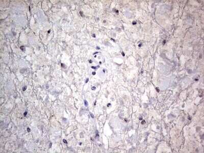 Immunohistochemistry: CLE7 homolog Antibody (OTI2A4) [NBP2-46591]
