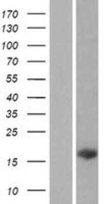 Western Blot: C14orf181 Overexpression Lysate [NBP2-04500]