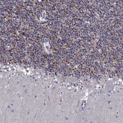 Immunohistochemistry-Paraffin: TMEM266 Antibody [NBP1-81939]