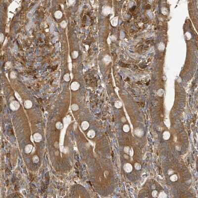 Immunohistochemistry-Paraffin: Arpin Antibody [NBP2-46747]