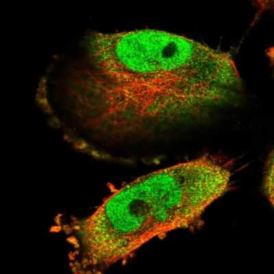 Immunocytochemistry/ Immunofluorescence: CCDC9B Antibody [NBP1-93764]