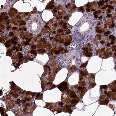 Immunohistochemistry-Paraffin: CCDC32 Antibody [NBP1-91218]