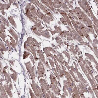Immunohistochemistry-Paraffin: C15orf65 Antibody [NBP2-38100]