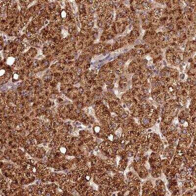 Immunohistochemistry-Paraffin: C16orf46 Antibody [NBP1-83526]