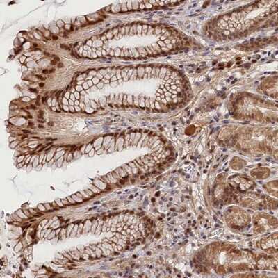Immunohistochemistry-Paraffin: C16orf46 Antibody [NBP1-83527]