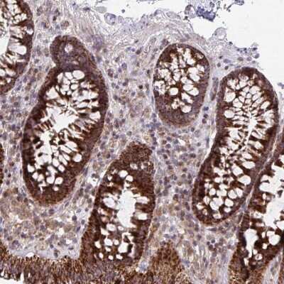 Immunohistochemistry: C16orf54 Antibody [NBP2-32553]