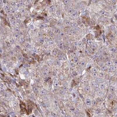 Immunohistochemistry: C16orf54 Antibody [NBP2-32553]