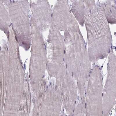 Immunohistochemistry-Paraffin: SPATA33 Antibody [NBP2-14382]