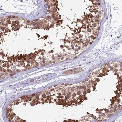 Immunohistochemistry-Paraffin: SPATA33 Antibody [NBP2-14382]