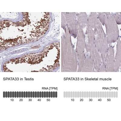Immunohistochemistry-Paraffin: SPATA33 Antibody [NBP2-14382]