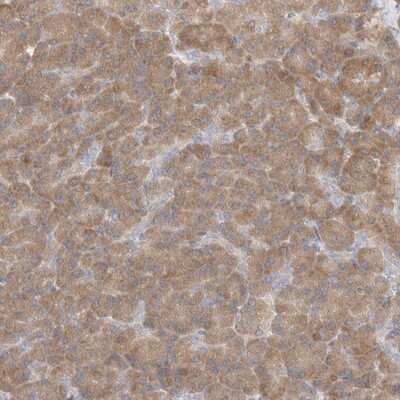 Immunohistochemistry-Paraffin: C16orf58 Antibody [NBP1-83692]