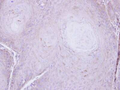 Immunohistochemistry-Paraffin: VPS35L Antibody [NBP1-32544]