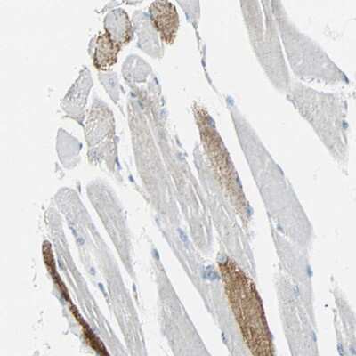 Immunohistochemistry-Paraffin: VPS9D1 Antibody [NBP1-88897]