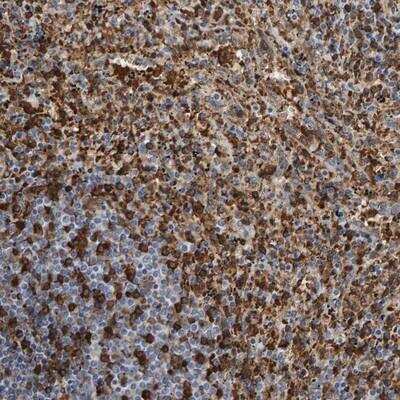 Immunohistochemistry-Paraffin: VPS9D1 Antibody [NBP1-88898]