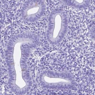 Immunohistochemistry-Paraffin: C16orf71 Antibody [NBP2-48935]