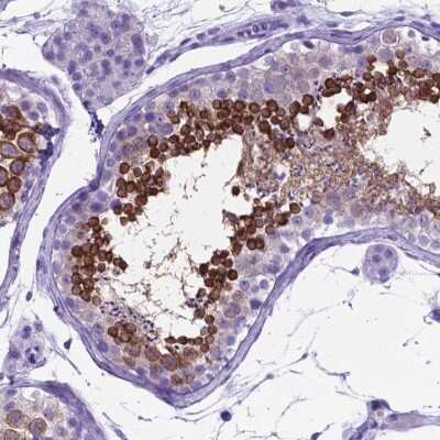 Immunohistochemistry-Paraffin: C16orf71 Antibody [NBP2-48935]