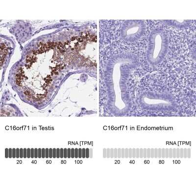 Immunohistochemistry-Paraffin: C16orf71 Antibody [NBP2-48935]