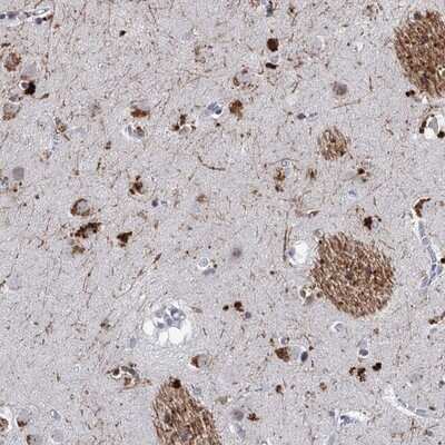 Immunohistochemistry-Paraffin: C16orf72 Antibody [NBP1-93773]