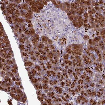 Immunohistochemistry-Paraffin: C16orf74 Antibody [NBP2-14680]