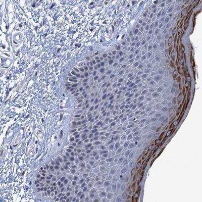 Immunohistochemistry: C16orf87 Antibody [NBP1-86230]