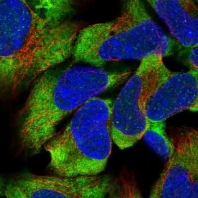 Immunocytochemistry/ Immunofluorescence: CCDC189 Antibody [NBP2-30829]