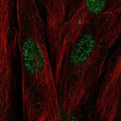 Immunocytochemistry/ Immunofluorescence: C17orf107 Antibody [NBP2-49613]