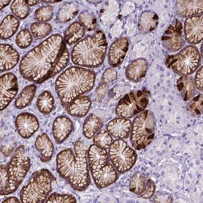 Immunohistochemistry-Paraffin: C17orf107 Antibody [NBP2-49613]