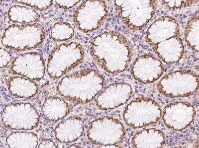 Immunohistochemistry-Paraffin: C17orf107 Antibody [NBP3-05905]