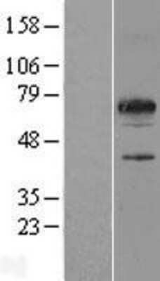 Western Blot: SPATA32 Overexpression Lysate [NBP2-05388]