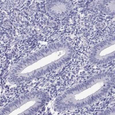 Immunohistochemistry-Paraffin: C17orf64 Antibody [NBP1-86197]