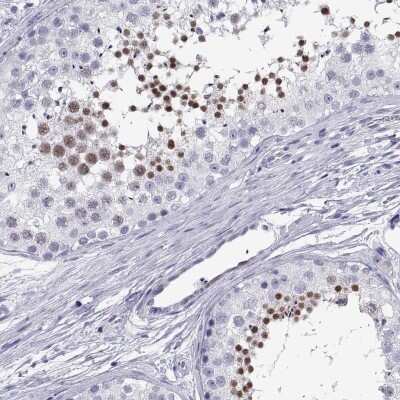 Immunohistochemistry-Paraffin: C17orf64 Antibody [NBP1-86197]